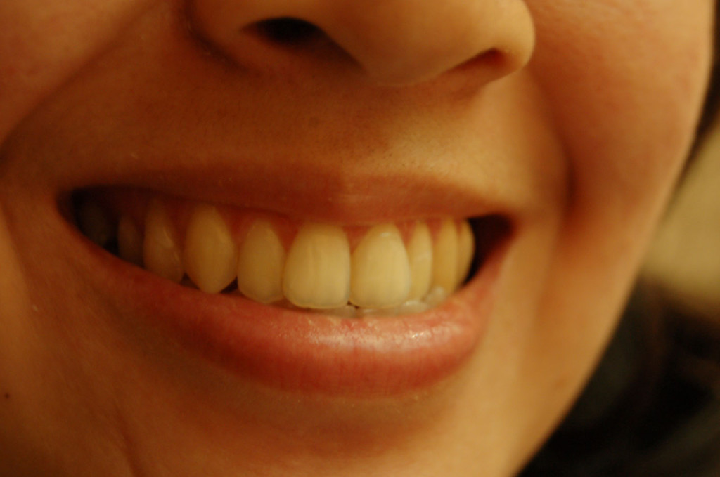 4 hammaste tundlikkuse põhjustajat